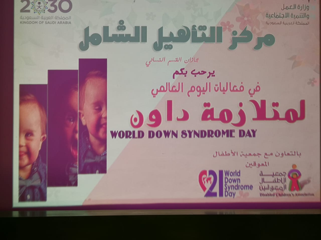 القسم النسائي بمركز التأهيل الشامل بجازان يفعل اليوم العالمي لمتلازمة داون٢٠١٩