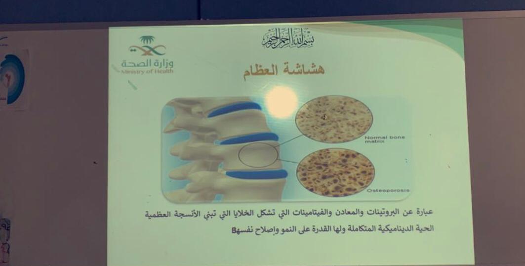 الشؤون الصحية المدرسية بتعليم مكة تُطلق فعاليات اليوم العالمي للتوعية بهشاشة العظام