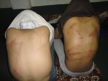 الشبكة اليمنية للحقوق والحريات ترصد (12636) مختطف ومختفي قسراً في تسع محافظات