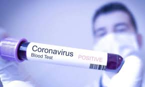 تسجيل 22 إصابة جديدة بفيروس كورونا في بر الصين الرئيسي