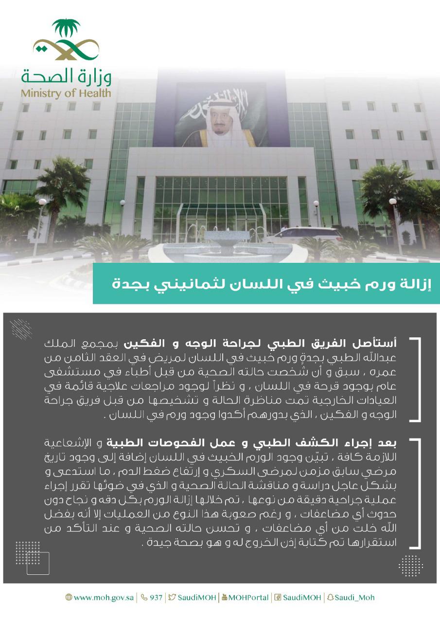 نجاح جراحة دقيقة في مجمع الملك عبدالله الطبي في جدة لإزالة ورم خبيث من لسان مريض