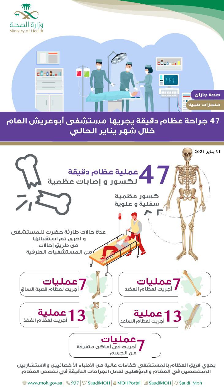 إجراء 47 جراحة عظام دقيقة في مستشفى أبوعريش العام