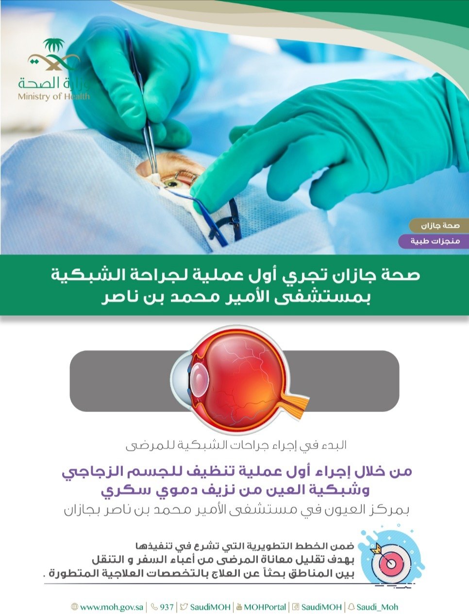 بدء إجراء جراحات الشبكية بمستشفى الأمير محمد بن ناصر في جازان