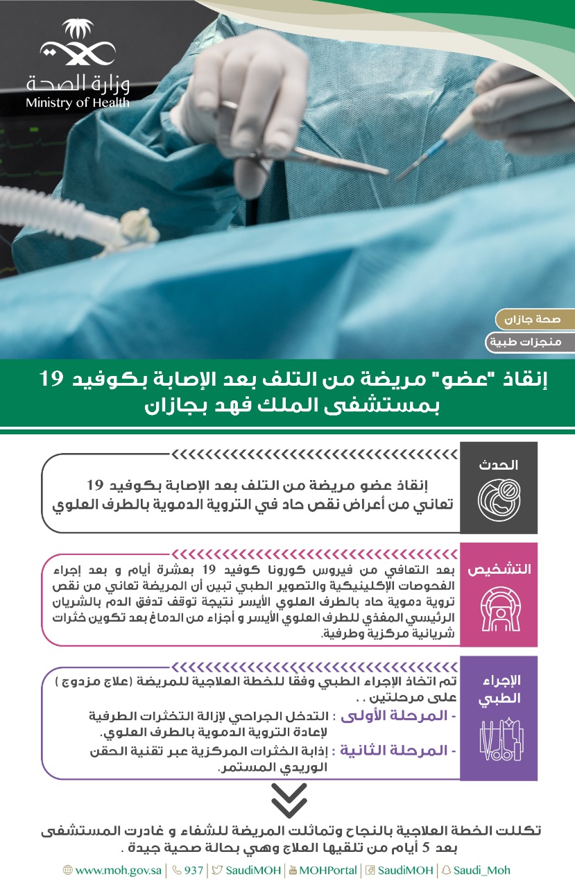 إنقاذ “عضو” مريضة من التلف بعد الإصابة بكوفيد ١٩ بمستشفى الملك فهد بجازان