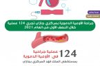 جراحة الأوعية الدموية بمركزي جازان تجري 124 عملية خلال النصف الأول من العام